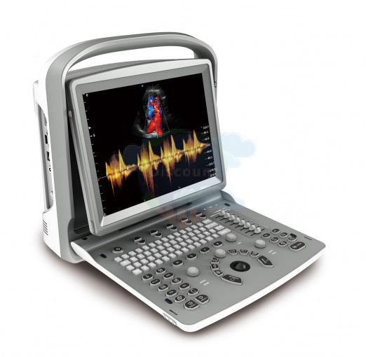 УЗИ аппарат CHISON SonoTouch 50 (ECO 6)